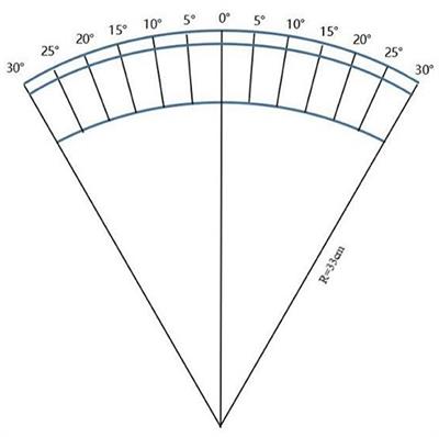 Nasal-temporal asymmetric changes in retinal peripheral refractive error in myopic adolescents induced by overnight orthokeratology lenses